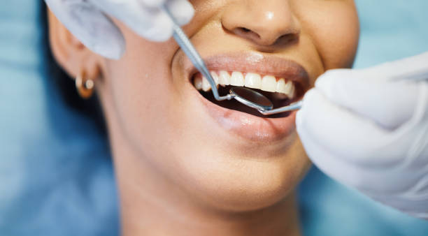 Best Emergency Broken Tooth Repair in Holly Ridge, NC